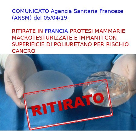 Protesi_mammaria_ritiro.jpg