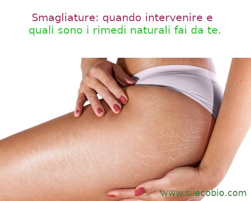 Smagliature_rimedi_naturali.jpg